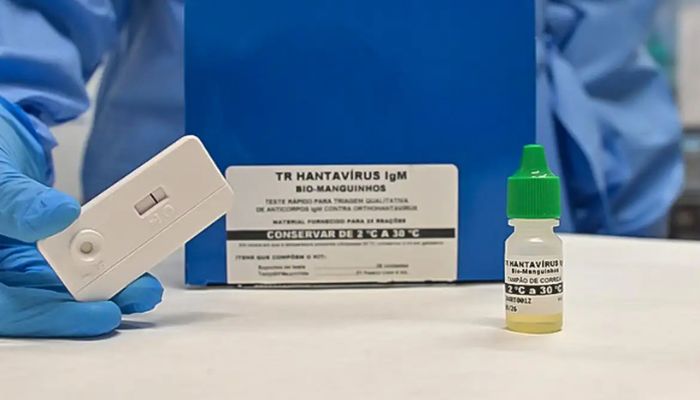 Novo teste faz diagnóstico de hantavirose em 20 minutos